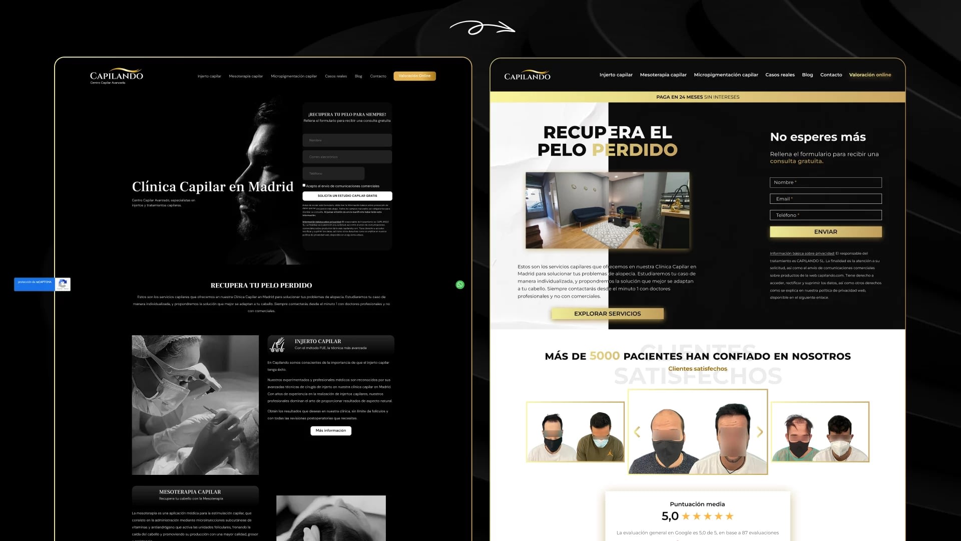 Diseño web para clínicas capilares en Madrid 36 Comparativa de diseño web para clínica capilar, antes sobrio en blanco y negro y después moderno y dinámico en Madrid.