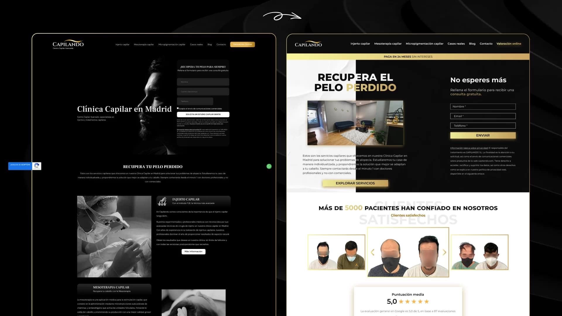 Diseño web para clínicas capilares en Madrid 40 Comparativa de diseño web para clínica capilar, antes sobrio en blanco y negro y después moderno y dinámico en Madrid.