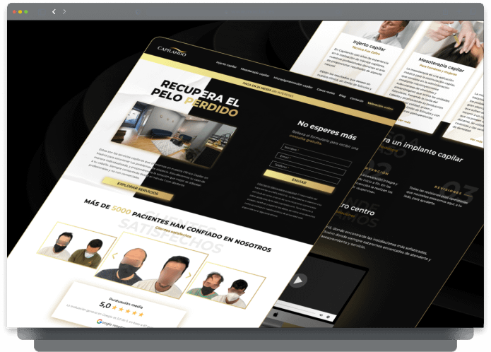 Próxima clínica de trasplante capilar con testimonios de pacientes satisfechos y diseño web moderno en Madrid.